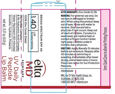 Inner Label (Inner Label)